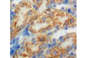 Used in DAB staining on fromalin fixed paraffin-embedded Kidney tissue (PDP anticorps  (AA 315-537))