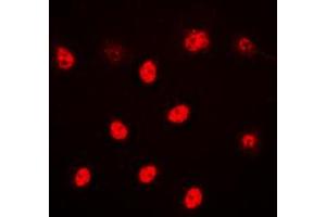 Immunofluorescent analysis of ALX3 staining in HeLa cells. (ALX3 anticorps  (Center))