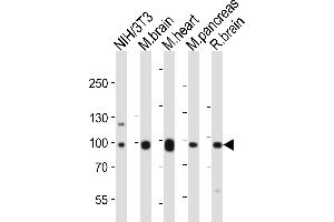 Western blot analysis of lysates from mouse NIH/3T3 cell line, mouse brain, mouse heart, mouse pancreas, rat brain tissue lysate (from left to right), using Ephb1 Antibody (Center) (ABIN6243651 and ABIN6577667). (EPH Receptor B1 anticorps  (AA 304-339))