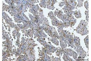 IHC analysis of BI-1/TMBIM6 using anti-BI-1/TMBIM6 antibody (ABIN7603199).