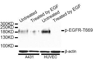 Western blot analysis of extracts of A-431 and HUVEC cells, using Phospho-EGFR-T669 antibody. (EGFR anticorps  (pThr669))