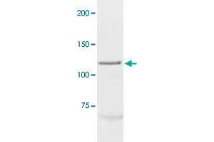 The cell lysate derived from MCF-7 was immunoprobed by PGR polyclonal antibody  at 1 : 500. (Progesterone Receptor anticorps  (C-Term))