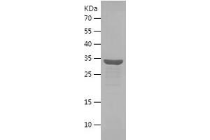 Western Blotting (WB) image for Heterogeneous Nuclear Ribonucleoprotein A2/B1 (HNRNPA2B1) (AA 1-260) protein (His tag) (ABIN7123319)