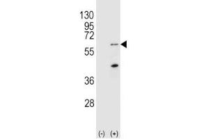 Western blot analysis of PINK1 antibody and 293 cell lysate (2 ug/lane) either nontransfected (Lane 1) or transiently transfected (2) with the Park6/PINK1 gene. (PINK1 anticorps  (AA 118-147))