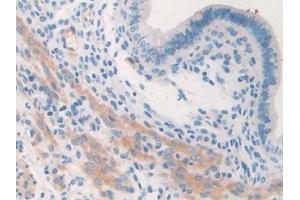 Detection of COL2a1 in Mouse Uterus Tissue using Polyclonal Antibody to Collagen Type II Alpha 1 (COL2a1)