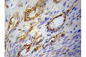 Immunohistochemistry (IHC) image for anti-Peroxisome Proliferator-Activated Receptor gamma (PPARG) antibody (ABIN1874206) (PPARG anticorps)