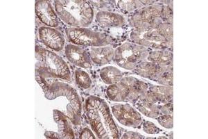 Immunohistochemical staining of human stomach with NLRP14 polyclonal antibody  shows moderate cytoplasmic positivity in glandular cells. (NLRP14 anticorps)