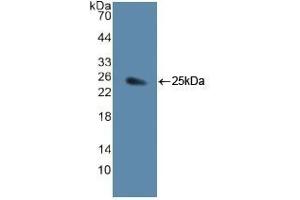 Detection of Recombinant JAG1, Human using Polyclonal Antibody to Jagged 1 (JAG1) (JAG1 anticorps  (AA 836-1047))