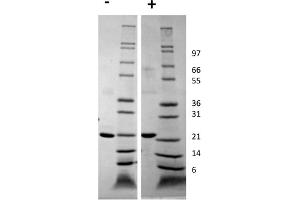 SDS-PAGE of Human Growth Hormone Recombinant Protein SDS-PAGE of Human Growth Hormone Recombinant Protein. (Growth Hormone 1 Protein (GH1))