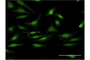 Immunofluorescence of monoclonal antibody to PRKCD on HeLa cell. (PKC delta anticorps  (AA 577-676))