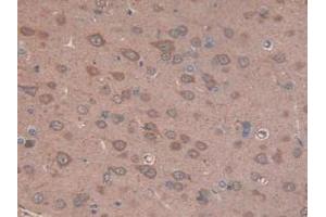 IHC-P analysis of Rat Brain Tissue, with DAB staining. (CS anticorps  (AA 56-312))