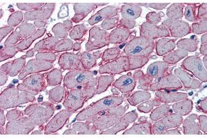 Immunohistochemistry with Human Heart lysate tissue at an antibody concentration of 5.
