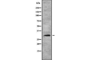 Western blot analysis FHL3 using HT29 whole cell lysates (FHL3 anticorps  (Internal Region))