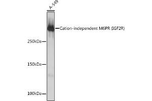 Western blot analysis of extracts of A-549 cells, using Cation-independent Cation-independent M6PR (IGF2R) (IGF2R) Rabbit mAb (ABIN1678848, ABIN3018066, ABIN3018067 and ABIN7101574) at 1:1000 dilution.