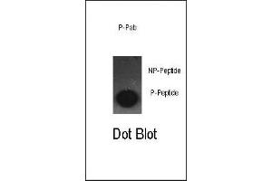 Dot blot analysis of anti-Phospho-cJun-S63 Antibody (ABIN389545 and ABIN2839590) on nitrocellulose membrane.