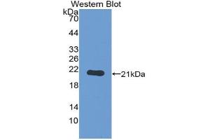 Western blot analysis of the recombinant protein. (TLR7 anticorps  (AA 890-1037))