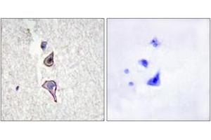 Immunohistochemistry analysis of paraffin-embedded human brain tissue, using MRC2 Antibody.