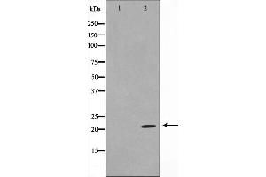 Western blot analysis on Jurkat cell lysate using TPD54 Antibody，The lane on the left is treated with the antigen-specific peptide.
