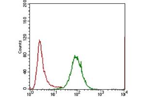 Immunohistochemical analysis of paraffin-embedded lung cancer tissues using IL3RA antibody with DAB staining. (IL3RA anticorps  (AA 200-305))