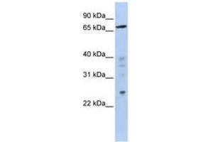 Image no. 1 for anti-Zinc Finger Protein 510 (ZNF510) (AA 611-660) antibody (ABIN6740579) (ZNF510 anticorps  (AA 611-660))