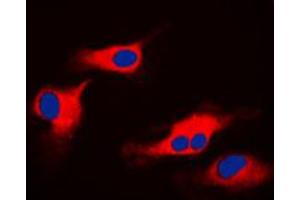 Immunofluorescent analysis of ORAOV1 staining in HeLa cells.