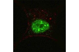 Fluorescent confocal image of SY5Y cells stained with p-STAT3 antibody at 1:200.