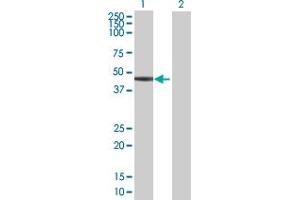 Western Blot analysis of SERPINB6 expression in transfected 293T cell line by SERPINB6 MaxPab polyclonal antibody. (SERPINB6 anticorps  (AA 1-376))