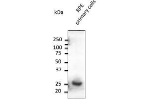 Western Blotting (WB) image for anti-RAB31, Member RAS Oncogene Family (RAB31) (C-Term) antibody (ABIN6254190) (RAB31 anticorps  (C-Term))