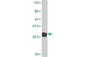 Western Blot detection against Immunogen (36. (PROS1 anticorps  (AA 419-516))