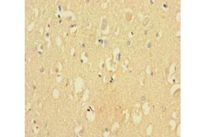 Immunohistochemistry of paraffin-embedded human brain tissue using ABIN7148873 at dilution of 1:100