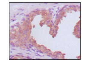 Immunohistochemistry (IHC) image for anti-Prostate Specific Antigen (PSA) (AA 26-251) antibody (ABIN2983296) (Prostate Specific Antigen anticorps  (AA 26-251))