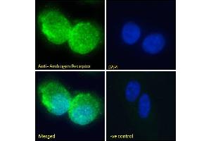 ABIN185266 Immunofluorescence analysis of paraformaldehyde fixed U2OS cells, permeabilized with 0.