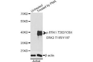 Western blot analysis of extracts of Jurkat cells, using Phospho-ERK1-T202/Y204 + ERK2-T185/Y187 antibody. (ERK1 anticorps  (pThr185, pThr187, pThr202, pThr204))