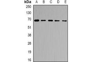 Western blot analysis of Ribophorin-2 expression in Jurkat (A), MCF7 (B), NIH3T3 (C), mouse liver (D), rat liver (E) whole cell lysates. (Ribophorin II anticorps)