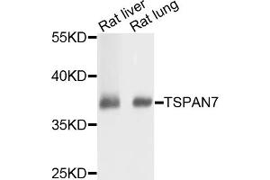 Western blot analysis of extracts of various cell lines, using TSPAN7 antibody (ABIN5973818) at 1/1000 dilution. (Tetraspanin 7 anticorps)