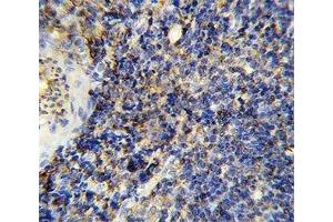 IHC analysis of FFPE human tonsil stained with CD45 antibody