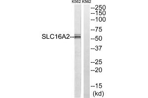 Western blot analysis of extracts from K562 cells, using SLC16A2 antibody. (SLC16A2/MCT8 anticorps  (Internal Region))