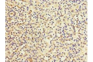 Immunohistochemistry of paraffin-embedded human spleen tissue using ABIN7158638 at dilution of 1:100 (LY75/DEC-205 anticorps  (AA 440-680))