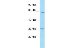 WB Suggested Anti-REEP3 Antibody Titration: 1. (REEP3 anticorps  (C-Term))