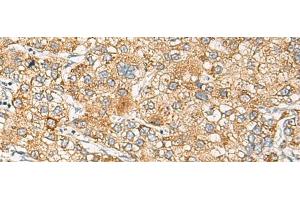 anti-Cellular Retinoic Acid Binding Protein 1 (CRABP1) antibody