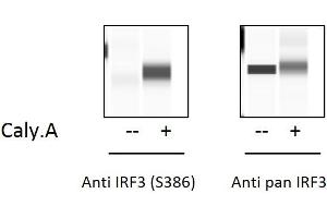 HT29 cells were treated or untreated with  Calyculin A and analyzed using this phosphoELISA and Western Blot. (IRF3 Kit ELISA)