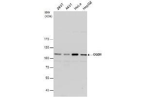 WB Image OGDH antibody detects OGDH protein by western blot analysis.