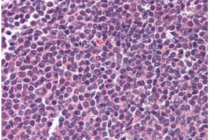 Human Spleen (formalin-fixed, paraffin-embedded) stained with RELA antibody ABIN218583 at 1:500 followed by biotinylated goat anti-rabbit IgG secondary antibody ABIN481713, alkaline phosphatase-streptavidin and chromogen.