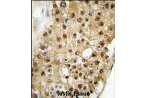 anti-Elongator complex protein 3 (ELP3) (AA 468-498), (C-Term) antibody