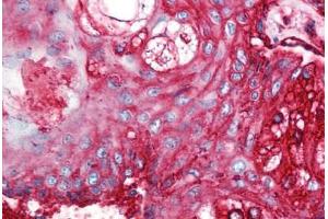Human Skin, Pilosebaceous Unit (formalin-fixed, paraffin-embedded) stained with CD59 antibody ABIN298470 at 5 ug/ml followed by biotinylated anti-mouse IgG secondary antibody ABIN481714, alkaline phosphatase-streptavidin and chromogen. (CD59 anticorps)