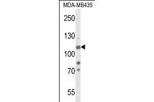 Western blot analysis of JMJD2B- (ABIN653576 and ABIN2842951) in MDA-M cell line lysates (35 μg/lane). (KDM4B anticorps  (AA 281-306))