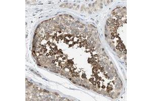 Immunohistochemical staining of human testis with KLHDC10 polyclonal antibody  shows strong cytoplasmic positivity in cells of the seminiferus ducts at 1:50-1:200 dilution. (KLHDC10 anticorps)