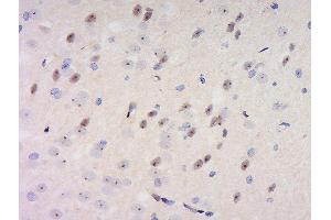 Formalin-fixed and paraffin embedded rat brain labeled with Anti-GDNFRA Polyclonal Antibody, Unconjugated  at 1:200 followed by conjugation to the secondary antibody and DAB staining. (GFRA1 anticorps  (AA 351-429))