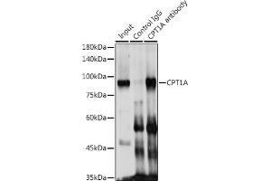 Immunofluorescence analysis of NIH/3T3 cells using CPT1A Rabbit pAb (ABIN6130129, ABIN6138976, ABIN6138977 and ABIN6220929) at dilution of 1:100 (40x lens).