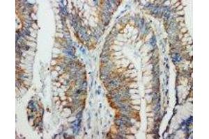 Image no. 1 for anti-Fas Ligand (TNF Superfamily, Member 6) (FASL) (C-Term) antibody (ABIN1492926)